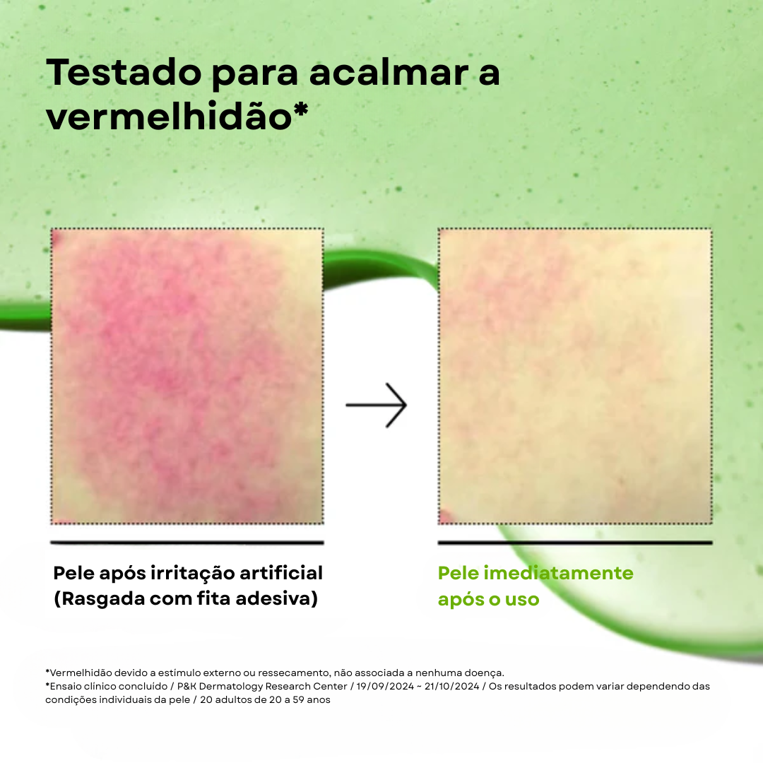 Acalma Peles Sensíveis