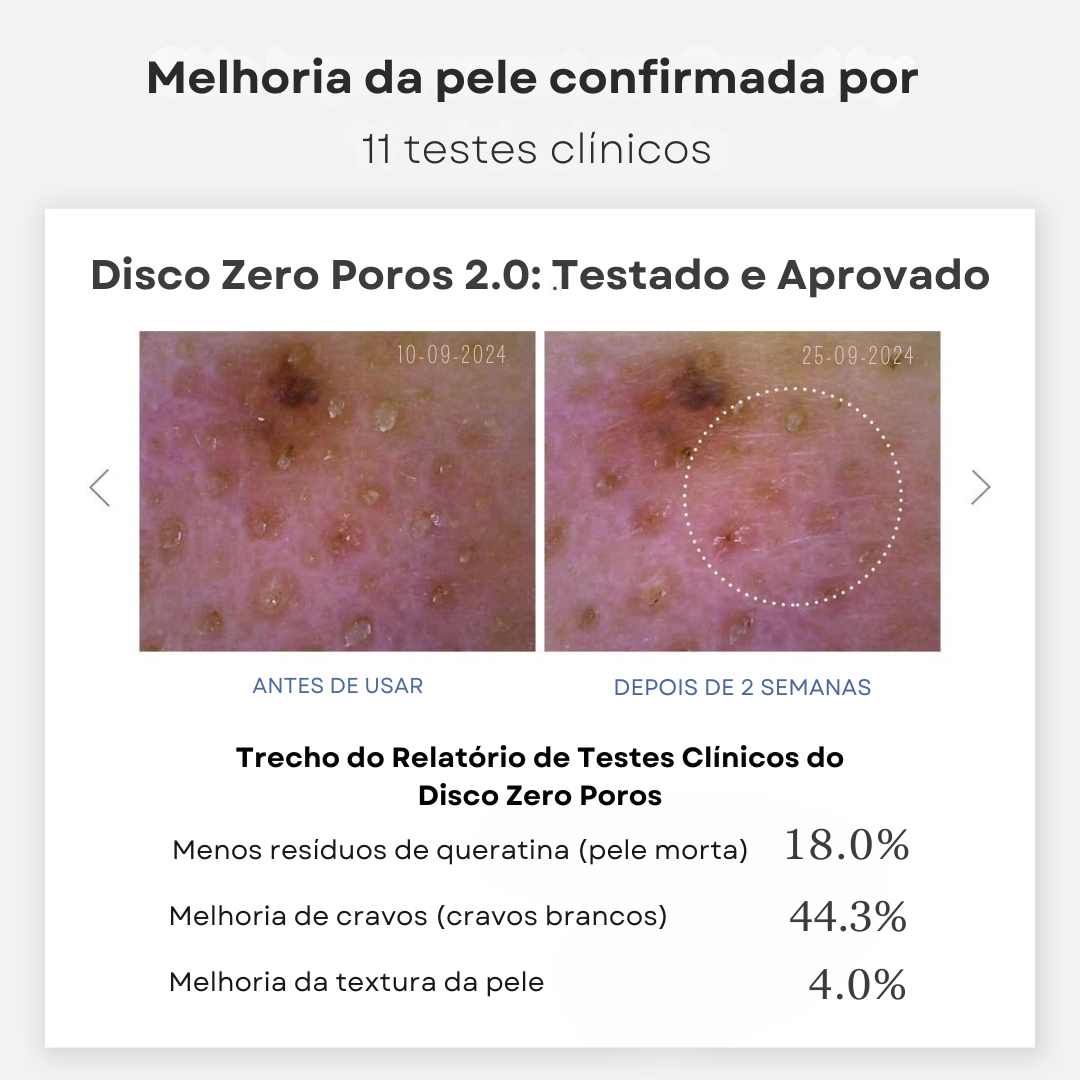 Textura Renovada em Discos