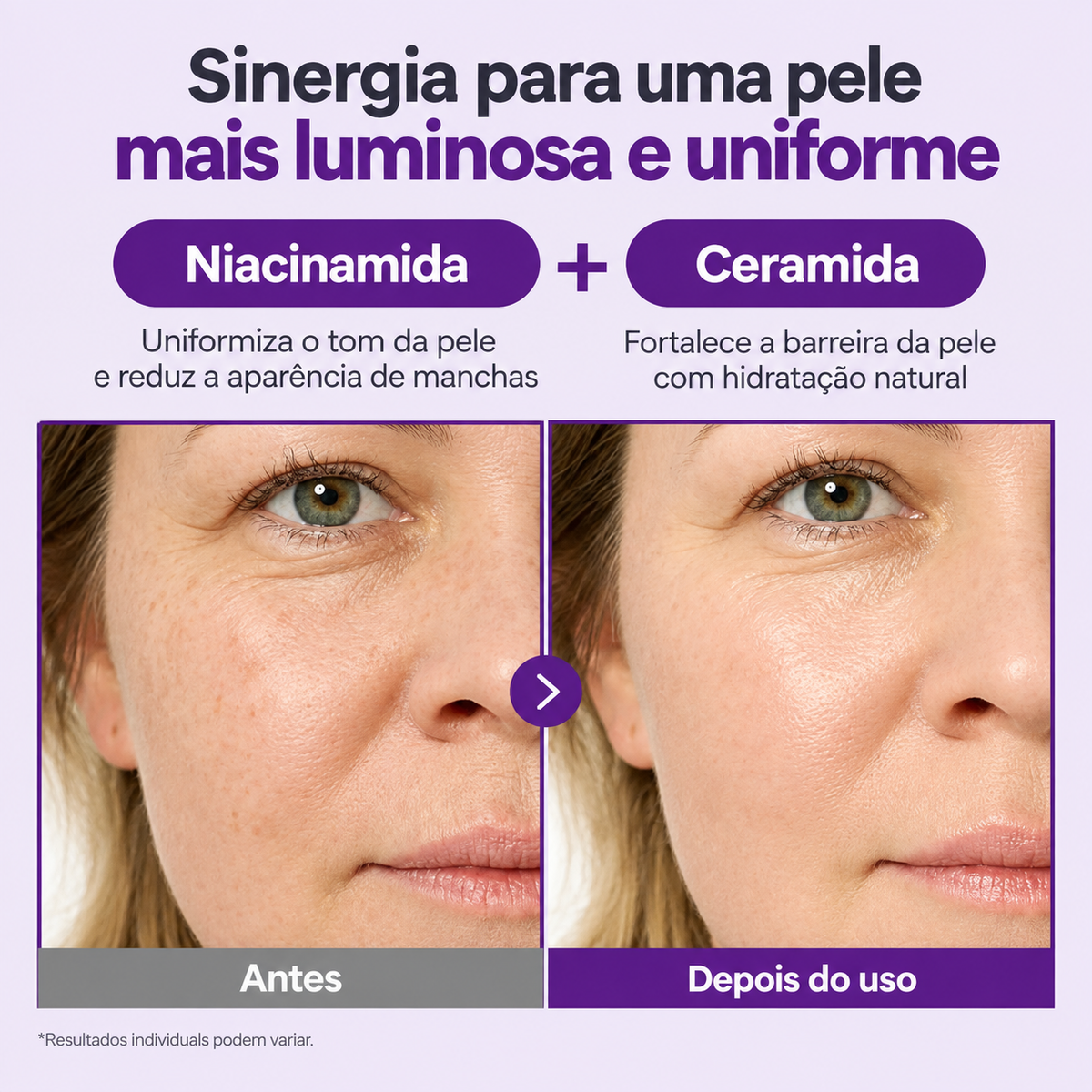 Volumetox Retiniano NAD+ para rugas e linhas finas