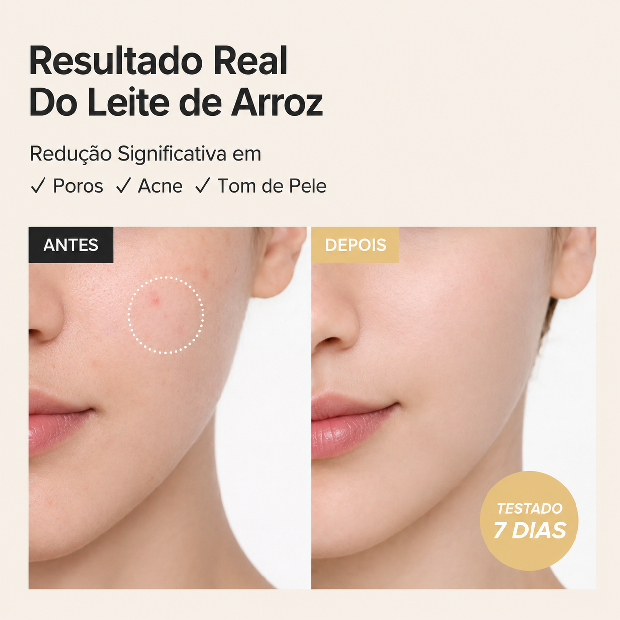 Controle de Oleosidade Tônico