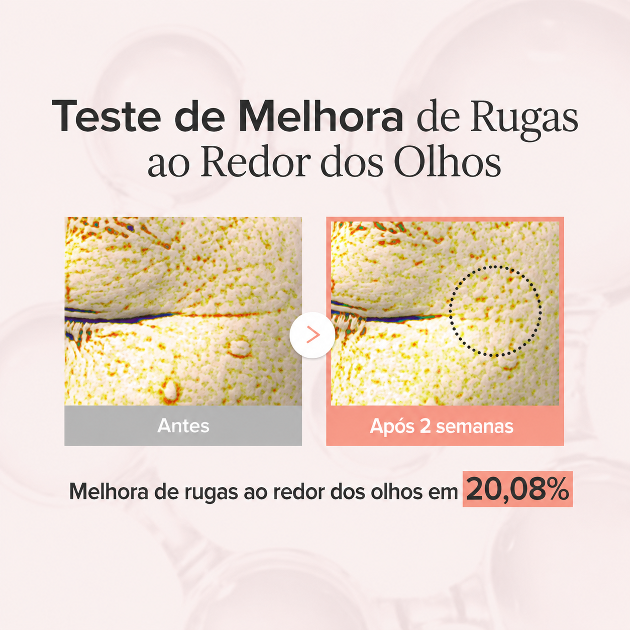 Antissinais Área dos Olhos