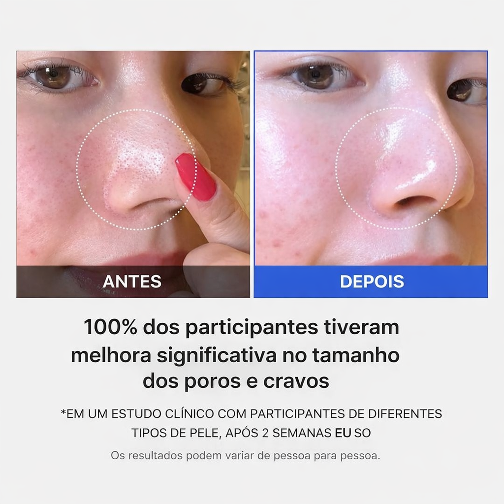 Melhora a textura da pele