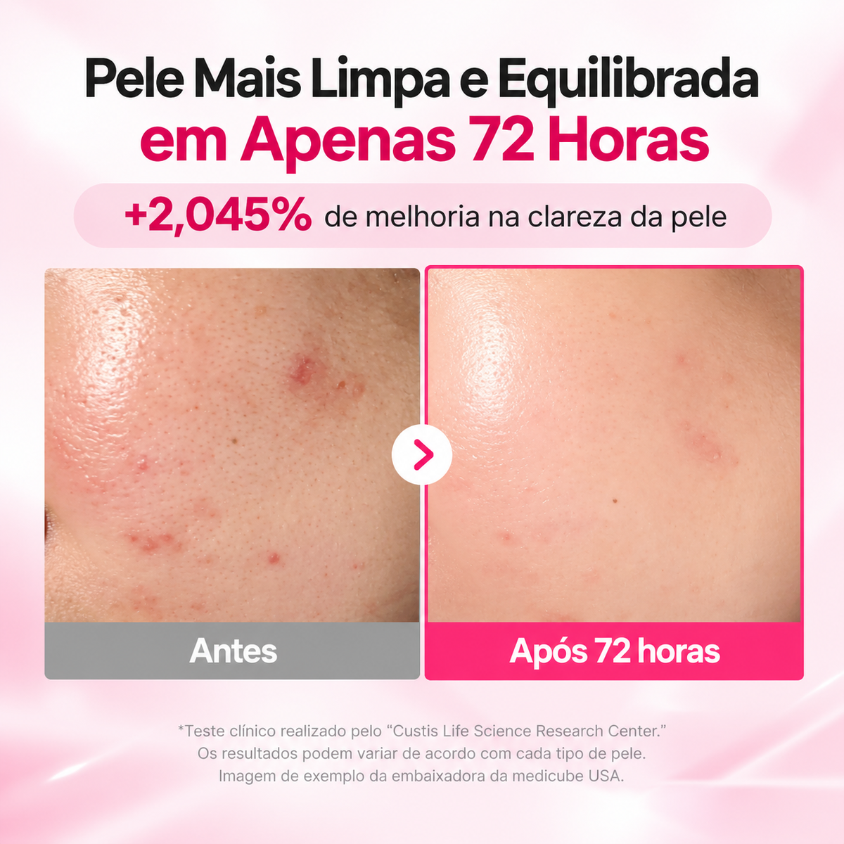 Medicube TXA Niacinamide Sérum com niacinamida 10% e arbutin