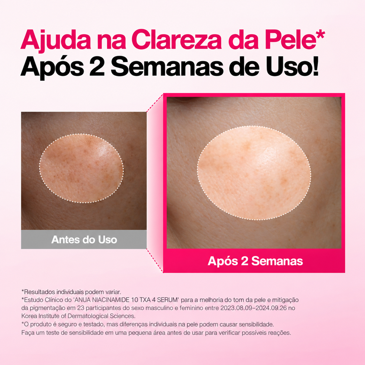 Kit sérum Anua Niacinamide 10 TXA 4 e Azelaic Acid 10