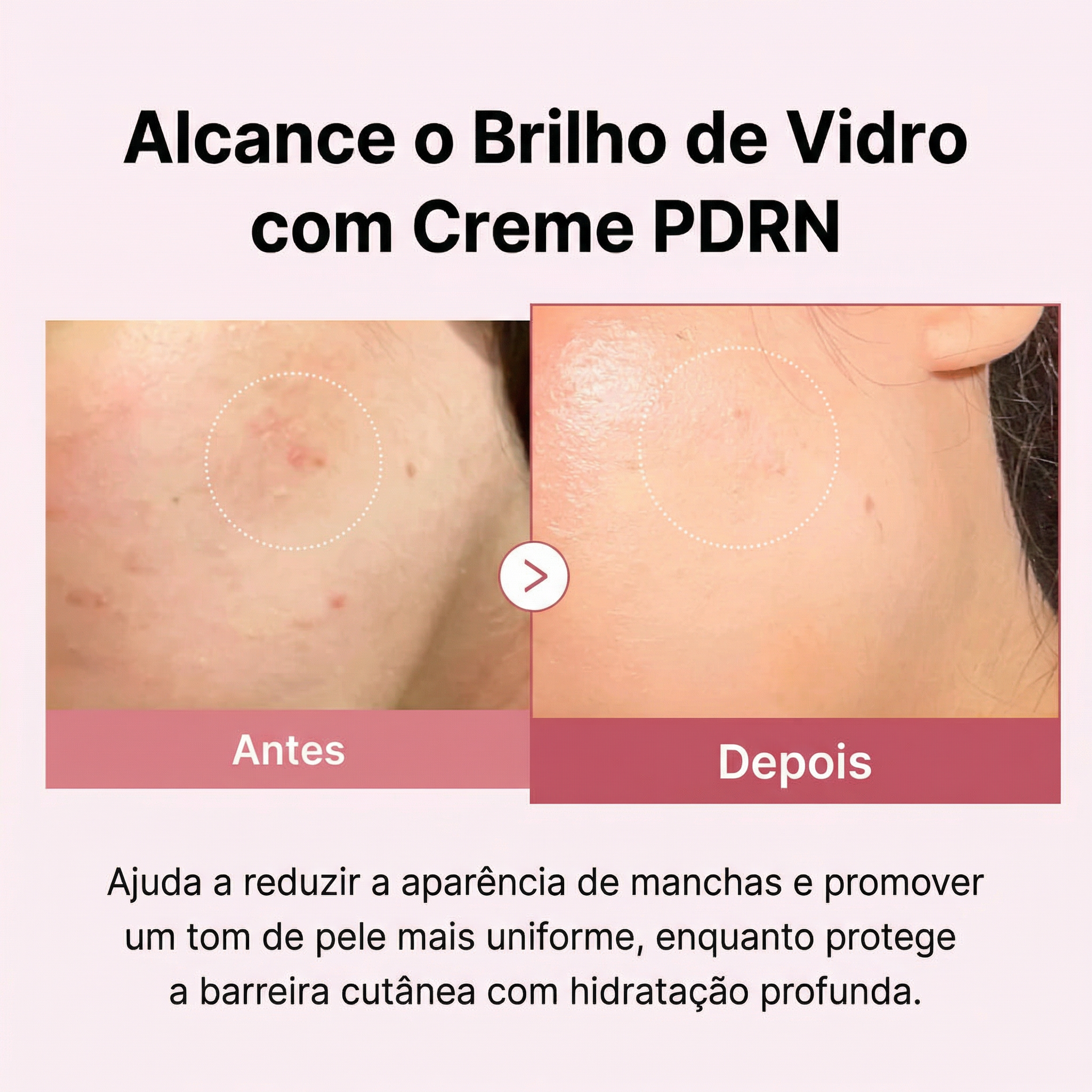 Creme facial com PDRN de salmão para recuperação da barreira cutânea e viço natural