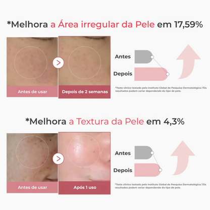 Firmeza e Elasticidade