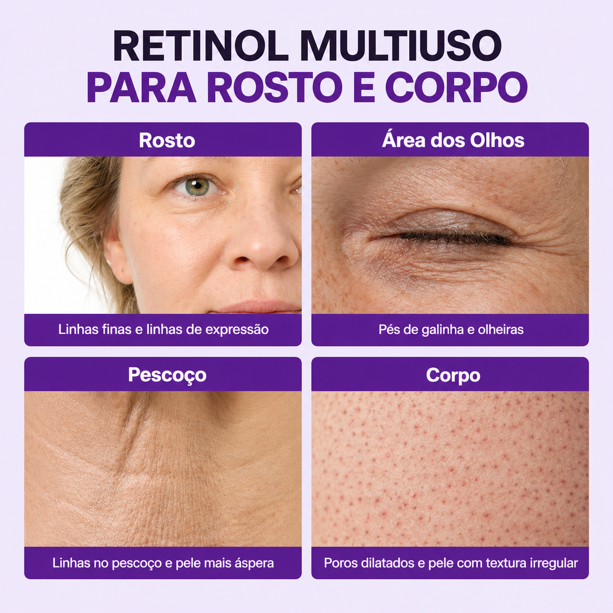 Tratamento para olhos com retinal encapsulado e NAD+