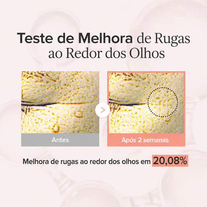 Antissinais Área dos Olhos