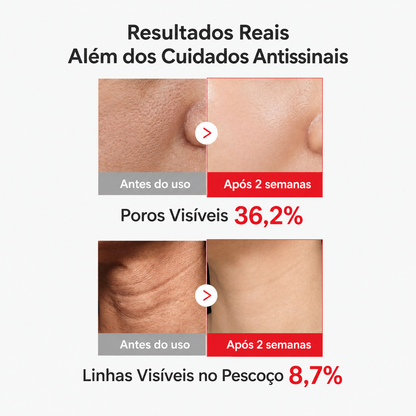 Aplicação do sérum anti-idade Medicube no pescoço