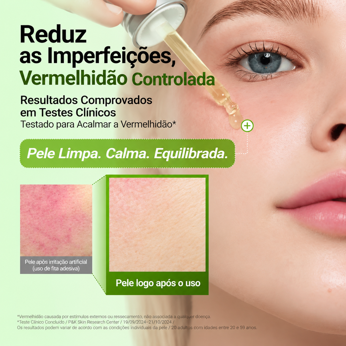 Acalma Peles Sensíveis