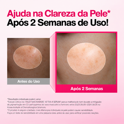 Kit sérum Anua Niacinamide 10 TXA 4 e Azelaic Acid 10