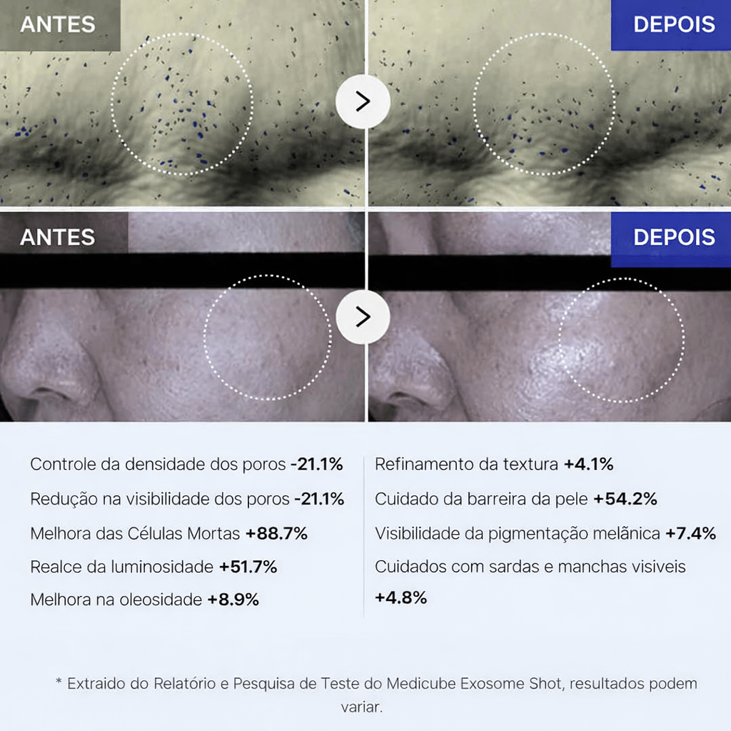 Sérum Medicube Exosome Shot 7500 Microagulhamento - Dermora