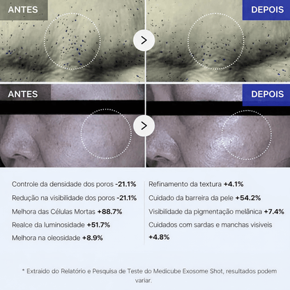 Sérum Medicube Exosome Shot 7500 Microagulhamento - Dermora